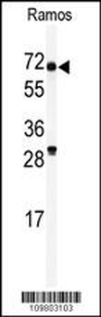 RIOK2 Antibody (C-term)
