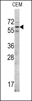 RIOK2 Antibody (Center)