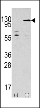 JIK (TAOK3) Antibody (C-term)