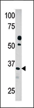 PDXK Antibody (C-term)