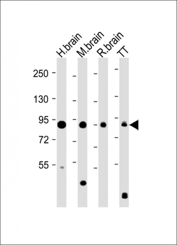 DCAMKL1 Antibody (C-term)