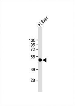 SPHK1 Antibody (Center)
