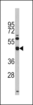 TGIF Antibody (Center L223)