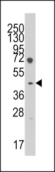 Lefty (LEFTB) Antibody (C-term)