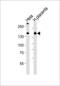 COL4A1 Antibody (N-term)
