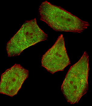COL4A1 Antibody (N-term)