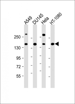 COL4A1 Antibody (N-term)