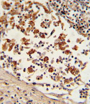 Bcl-6 Antibody (C-term)