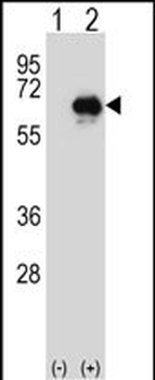 CETP Antibody (N-term)