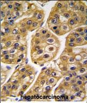 IDH1 Antibody (Center)