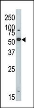 DYRK2 Antibody (N-term)