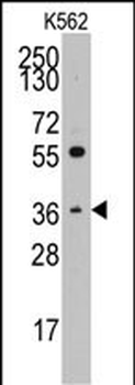 Thrombopoietin (TPO) Antibody (C-term)