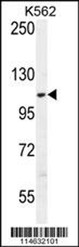 AARS2 Antibody (Center)