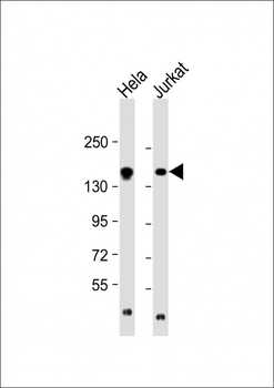 EPRS Antibody (N-term)