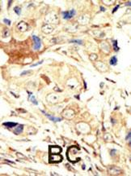 EGFR (ErbB1) Antibody (N-term)
