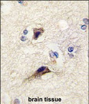 NTF3 Antibody (Center)