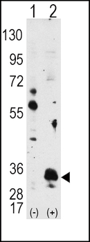 PIM1 Antibody
