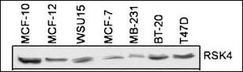 RSK4 Antibody (N-term)