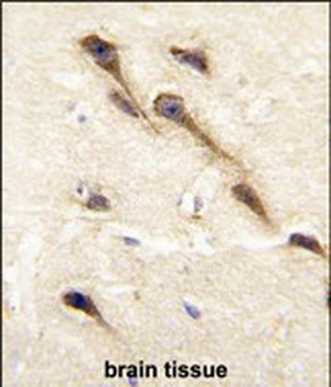 CYP26B1 Antibody (C-term)