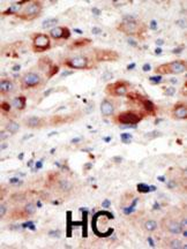PI3KC3 Antibody (N-term)