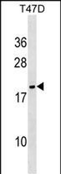NME6 Antibody (N-term)