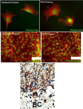 PACSIN2 Antibody (C-term)