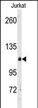 DGKD Antibody (C-term)