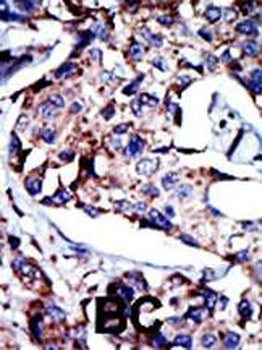 DGKD Antibody (C-term)