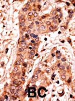 Guanylyl Cyclase alpha 2 (GUCY1A2) Antibody (C-term)