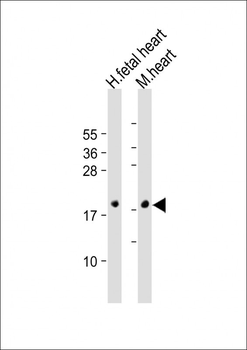 NPPA Antibody (N-term)