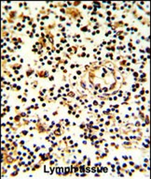 KLRD1 Antibody (N-term)