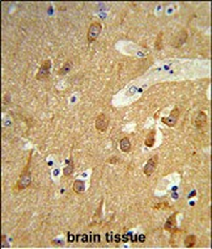TSPAN12 Antibody (C-term)