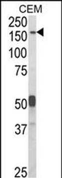 CNTNAP2 Antibody (Center)