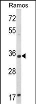 ACY3 Antibody (Center)
