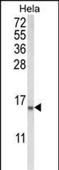 COTL1 Antibody (C-term)