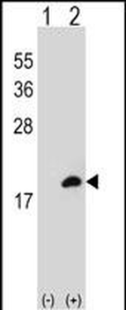 COTL1 Antibody (C-term)