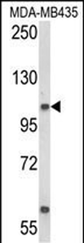 CASD1 Antibody (N-term)