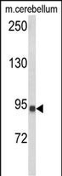 CASD1 Antibody (N-term)