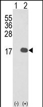 IL1F8 Antibody (N-term)