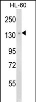LY75 Antibody (Center)