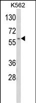 CDK5RAP1 Antibody (C-term)