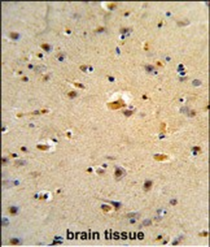 CDK5RAP1 Antibody (C-term)