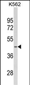 SDS Antibody (N-term)