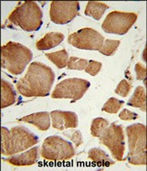 NRP1 Antibody (C-term)