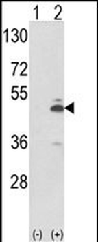 PKM2 (N-term E131) Antibody