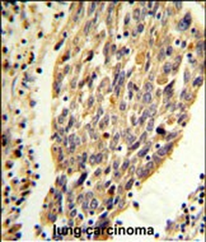 PKM2 (N-term E131) Antibody