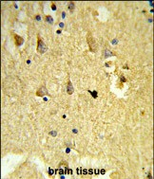 SH3BGRL3 Antibody (Center)