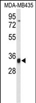 TFPT Antibody (N-term)