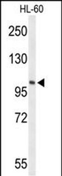 LIPE Antibody (C-term)