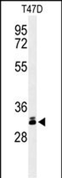 DKK1 Antibody (N-term)